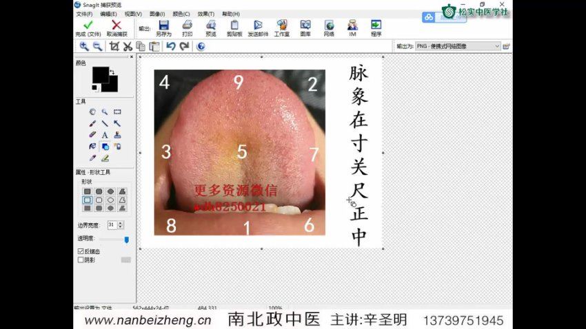 辛圣明第20期南北政脉诊实战录像全集39课 网盘分享(3.33G)